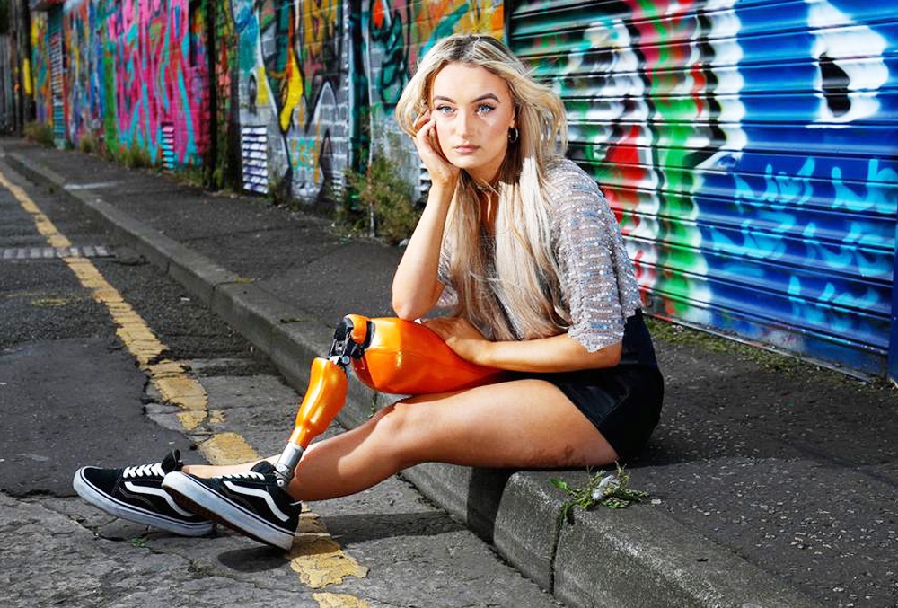 Co gai mat mot chan anh 6