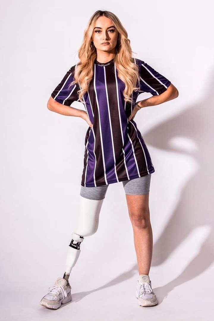 Co gai mat mot chan anh 7