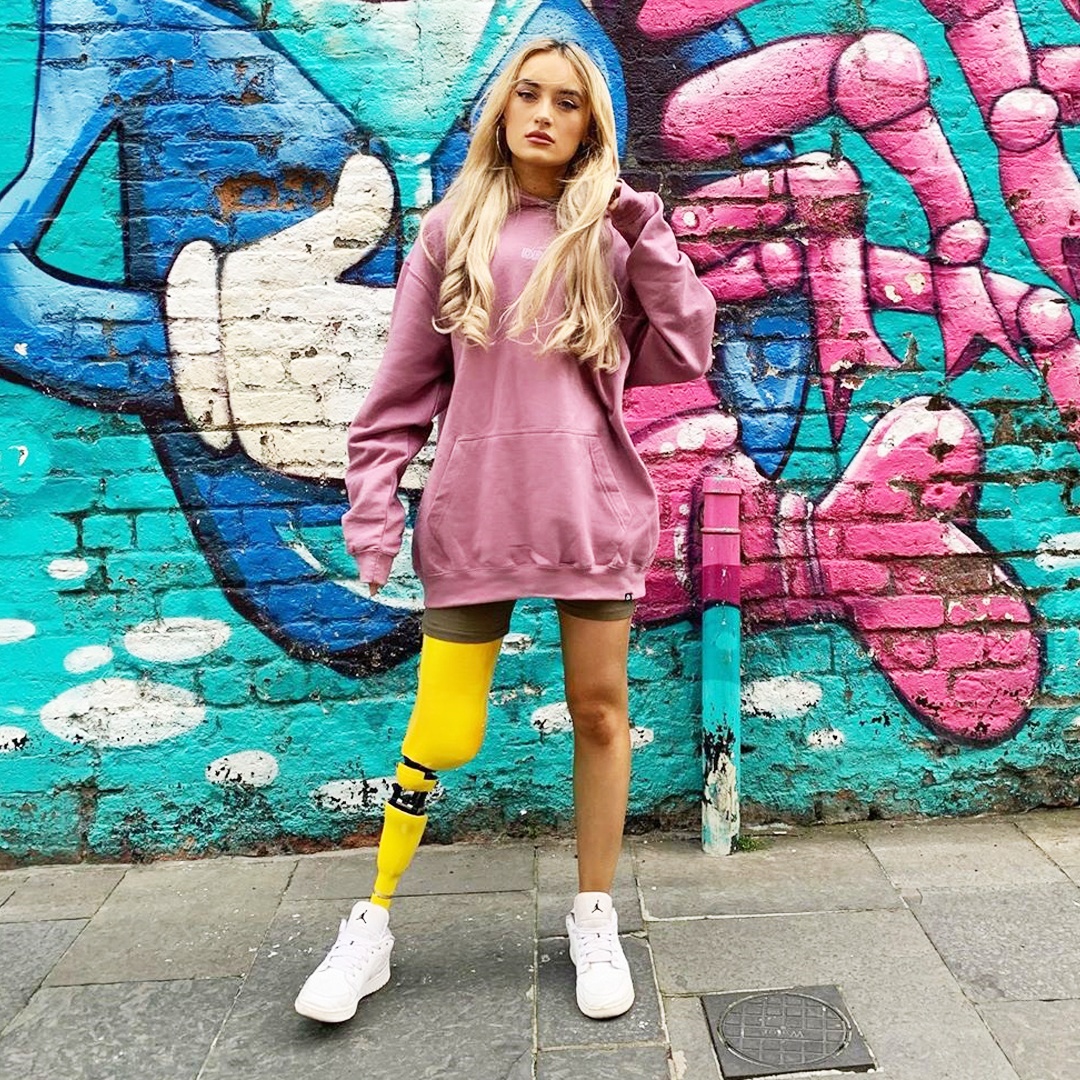 Co gai mat mot chan anh 8