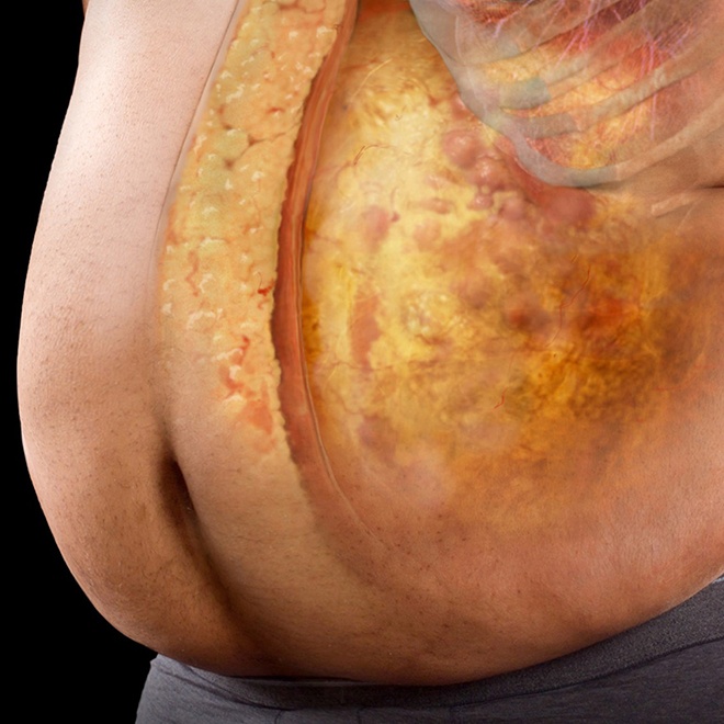 thuc pham gay mo bung anh 10