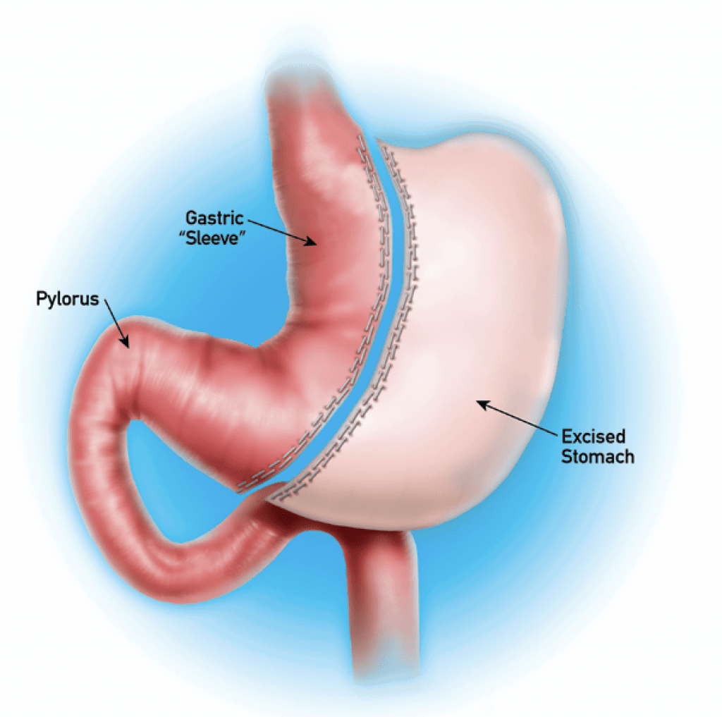 nguoi phu nu giam 74 kg anh 6