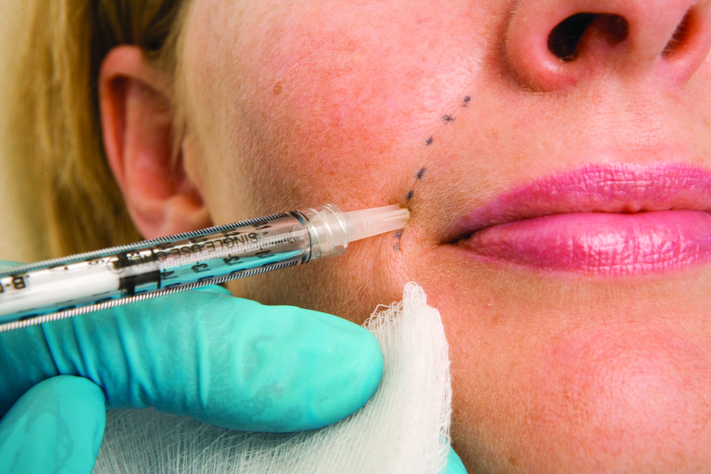 phau thuat tham my anh 4