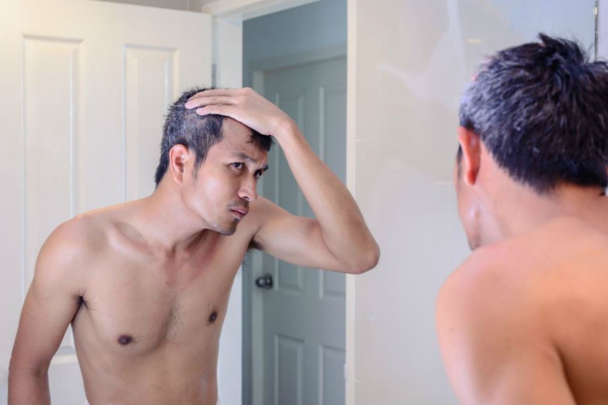 nguoi tre bi toc bac anh 4