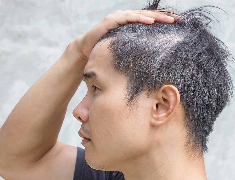 7 nguyen nhan khien nguoi tre co toc bac hinh anh