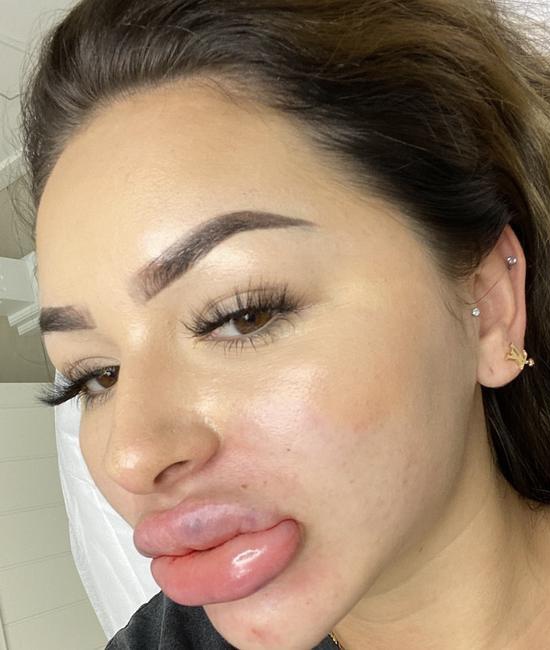 cô gái có đôi môi xúc xích ảnh 1 co gai co doi moi xuc xich anh 1