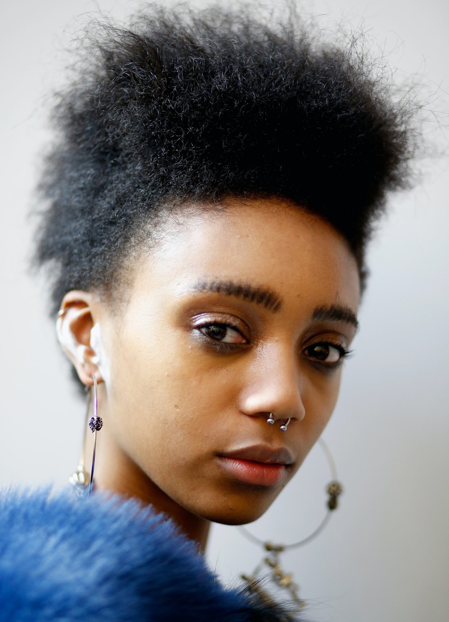 cach tri vet sung anh 7