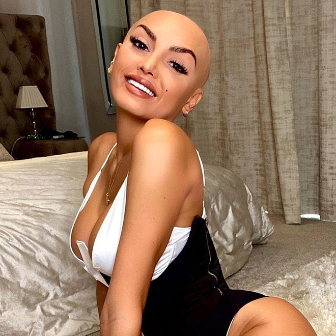 nu nguoi mau troc dau anh 11