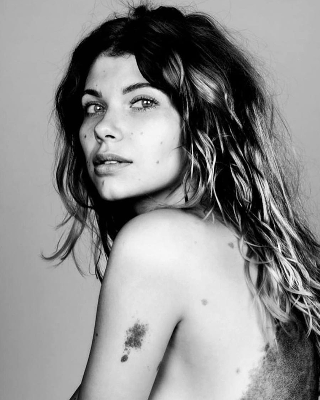 nu nguoi mau co vet bot anh 5