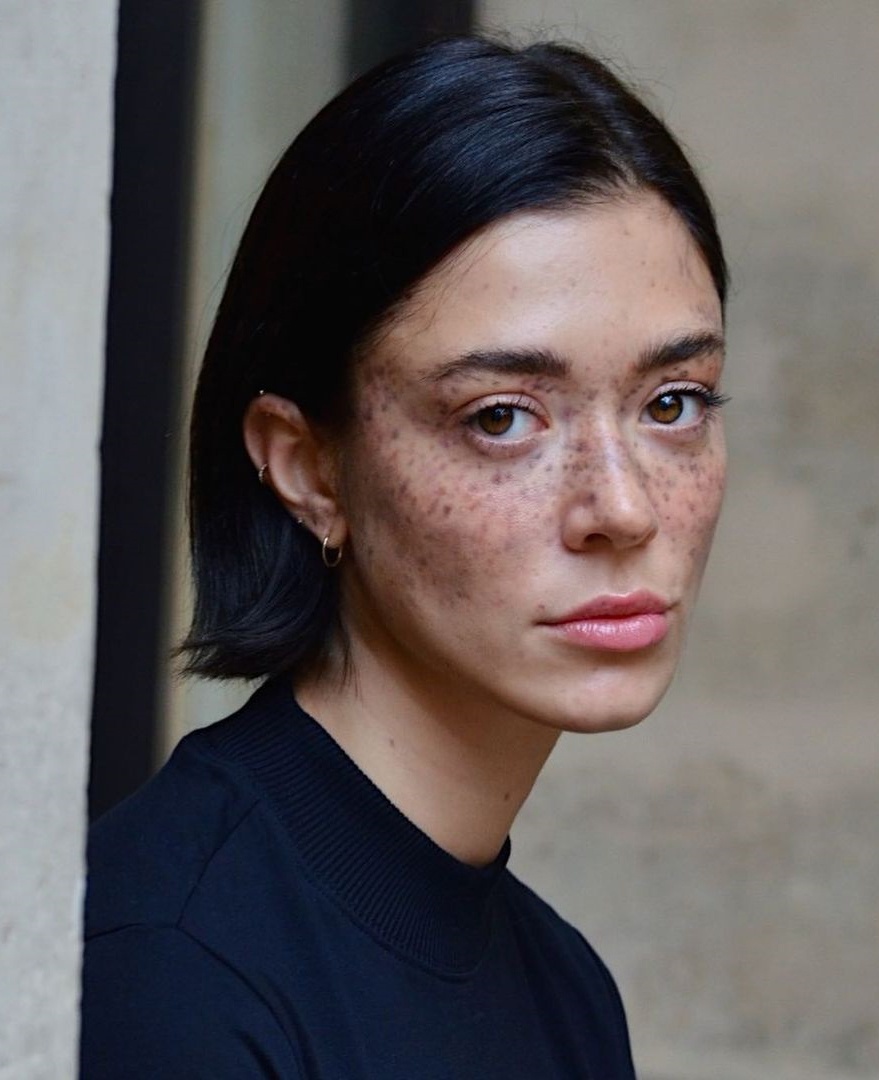 nu nguoi mau bi tan nhang anh 4