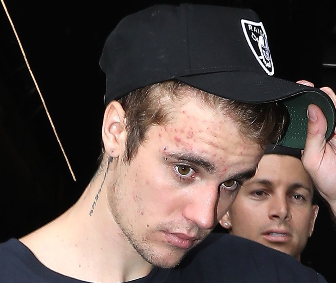 my pham khien da de bi mun anh 1