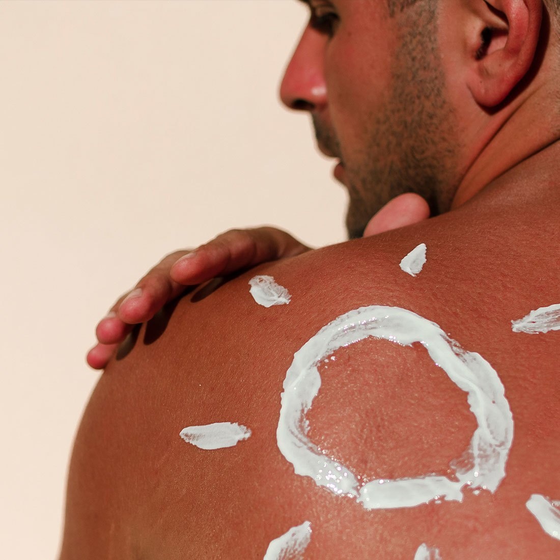 nguyen nhan gay nep nhan anh 2