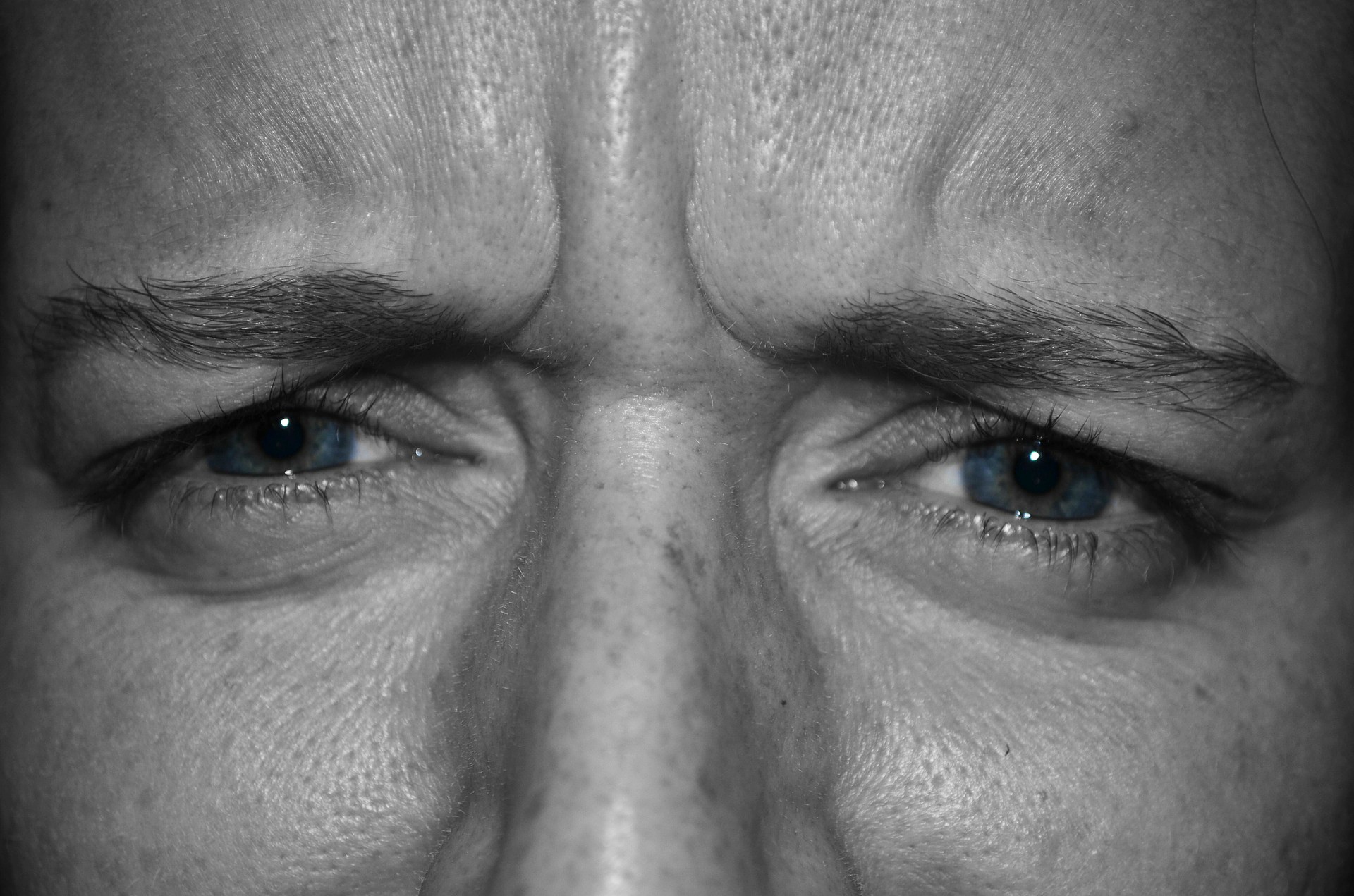 nguyen nhan gay nep nhan anh 8