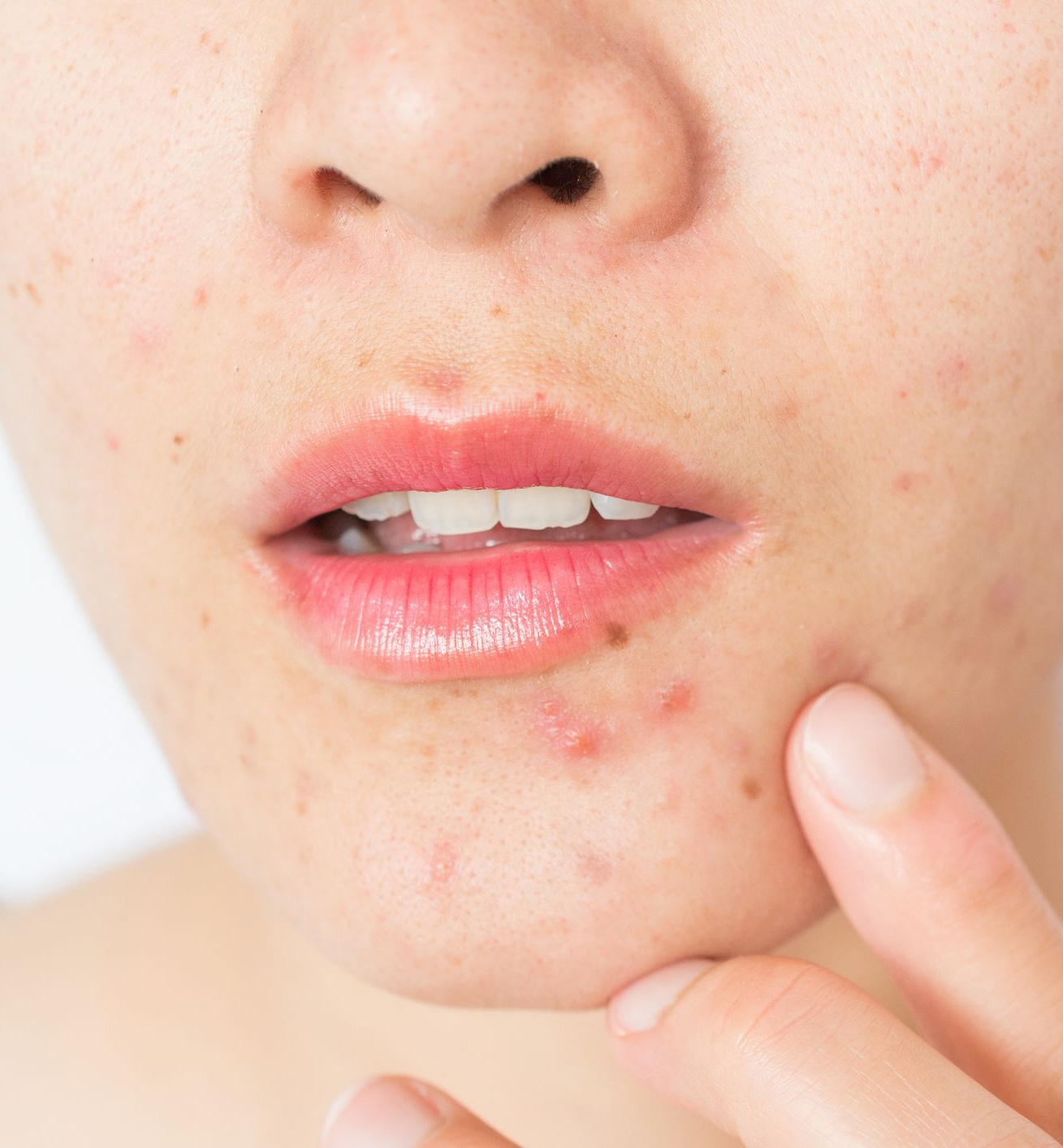 tac nhan gay hai cho da anh 7