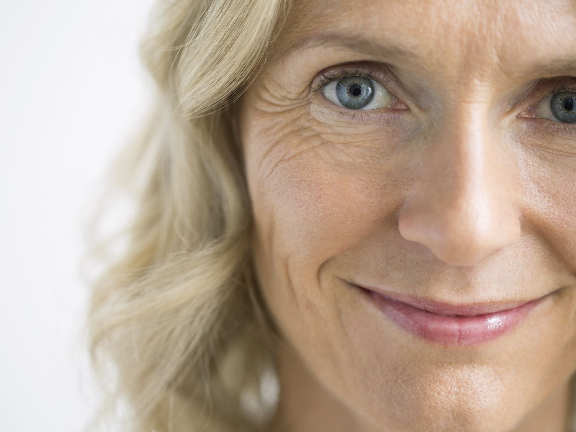 cach giam nep nhan anh 3