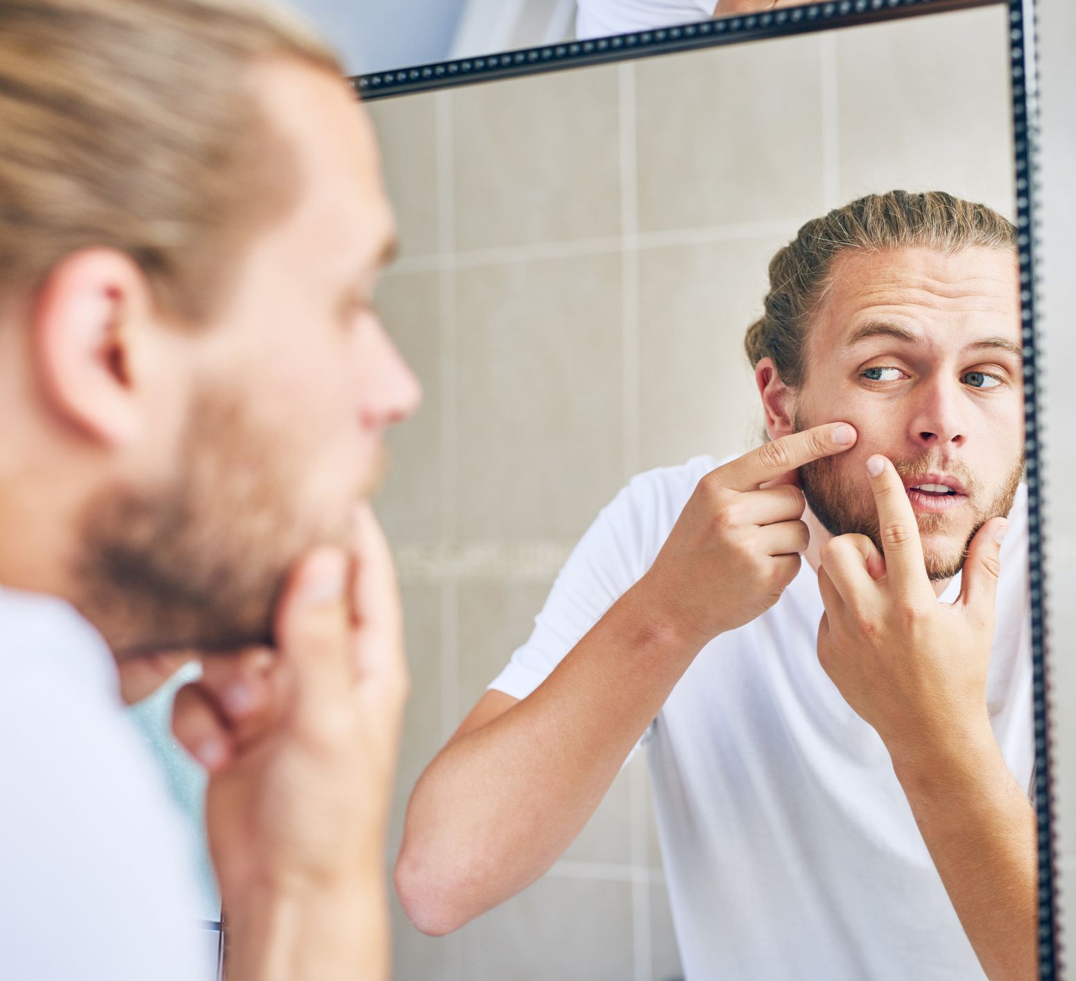 tri mun bang kem danh rang anh 4