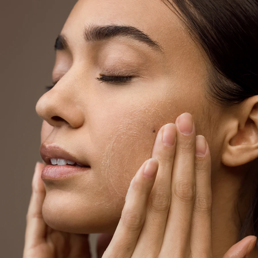 nguyen nhan khien da xau anh 4