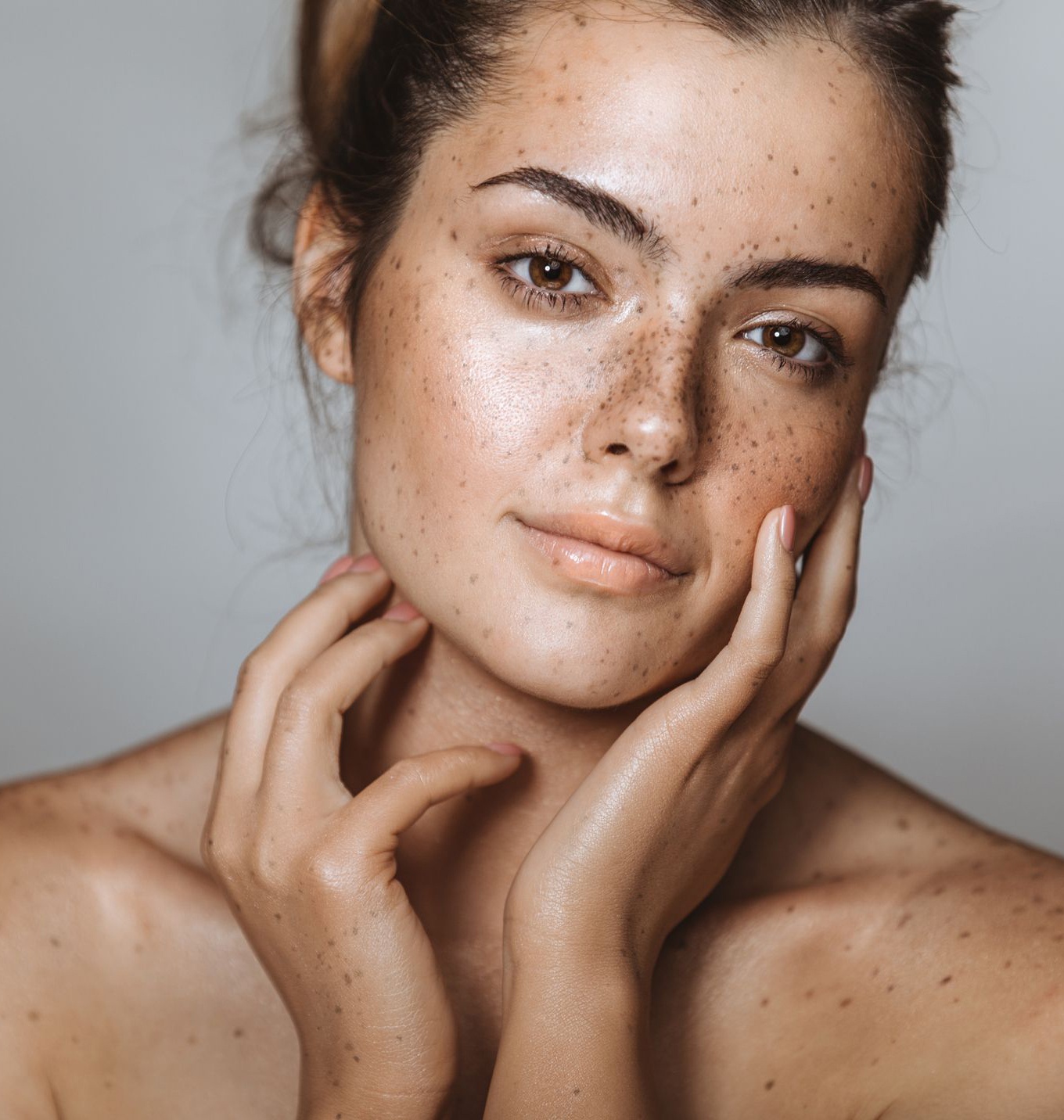 nguyen nhan khien da xau anh 5