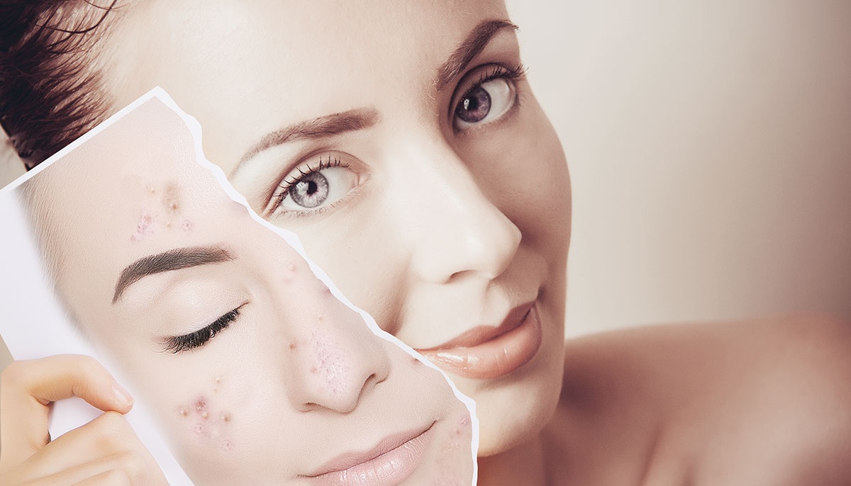 nguyen nhan khien da xau anh 8