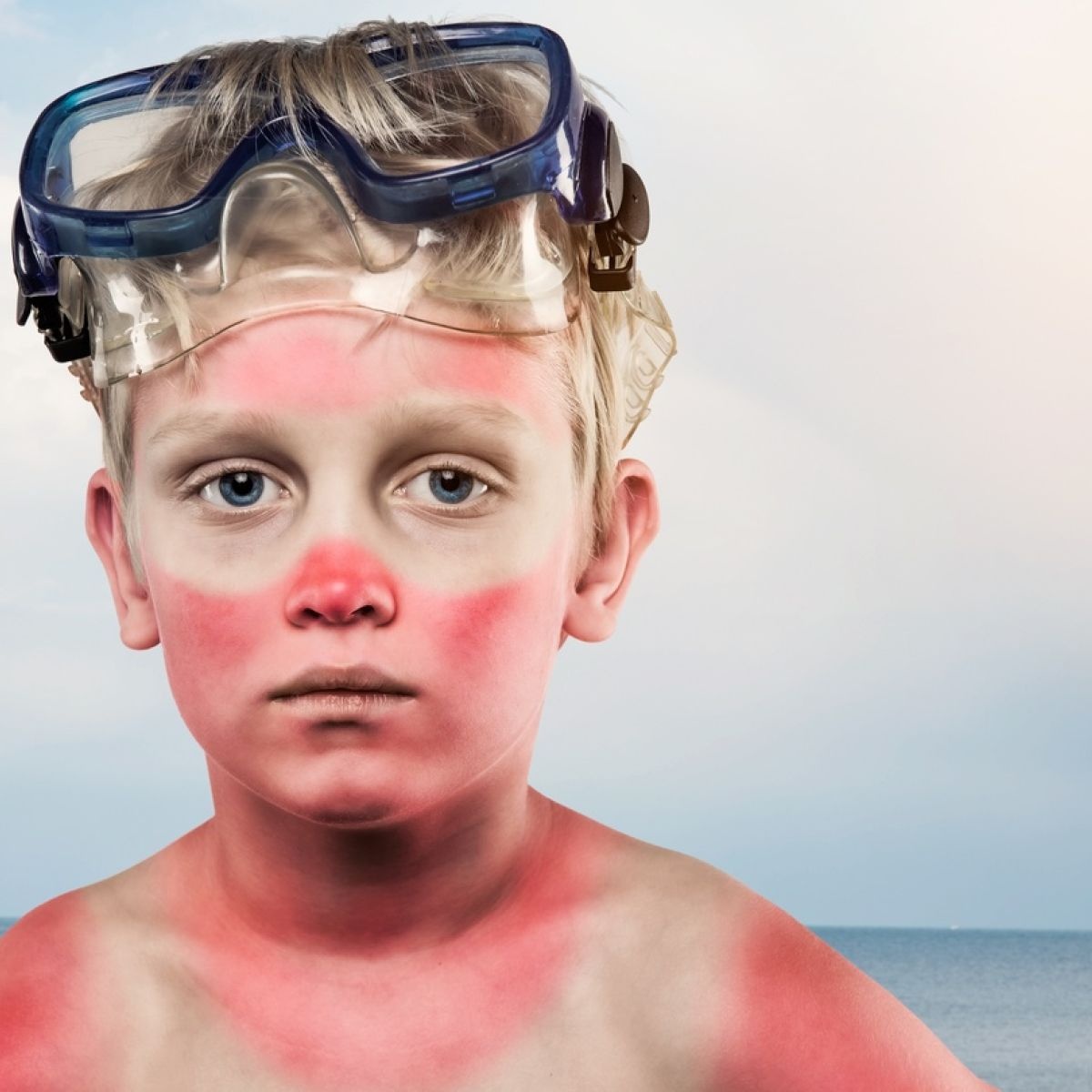 cach ngan ngua nep nhan anh 3