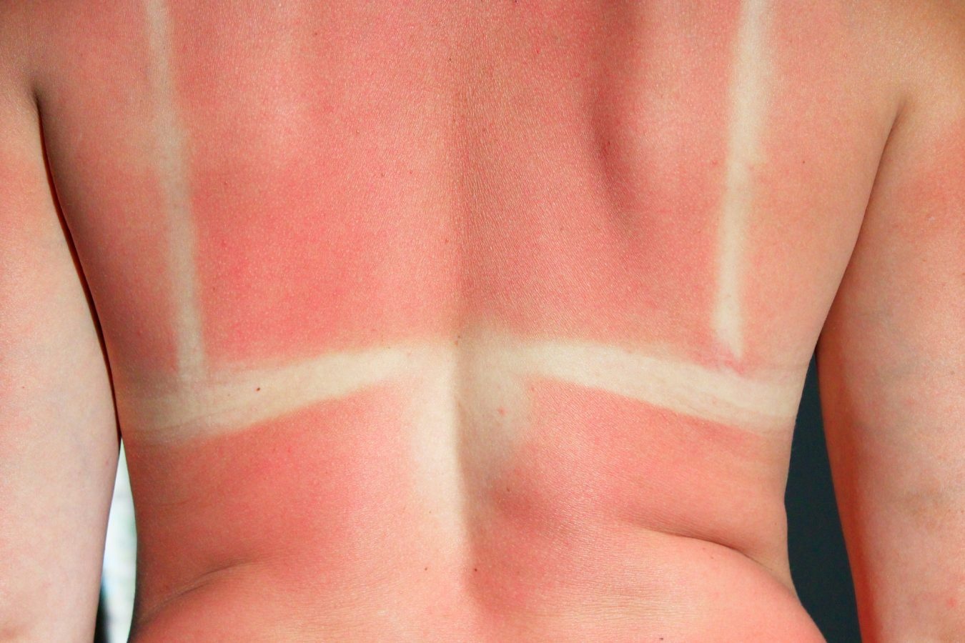 kem chong nang anh 3