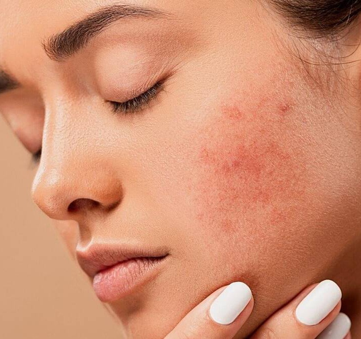 thoa kem chong nang sai cach anh 5