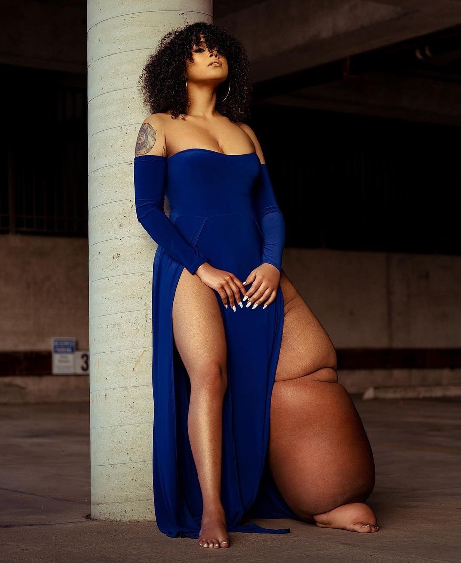 nguoi mau co chan trai sung phu anh 3