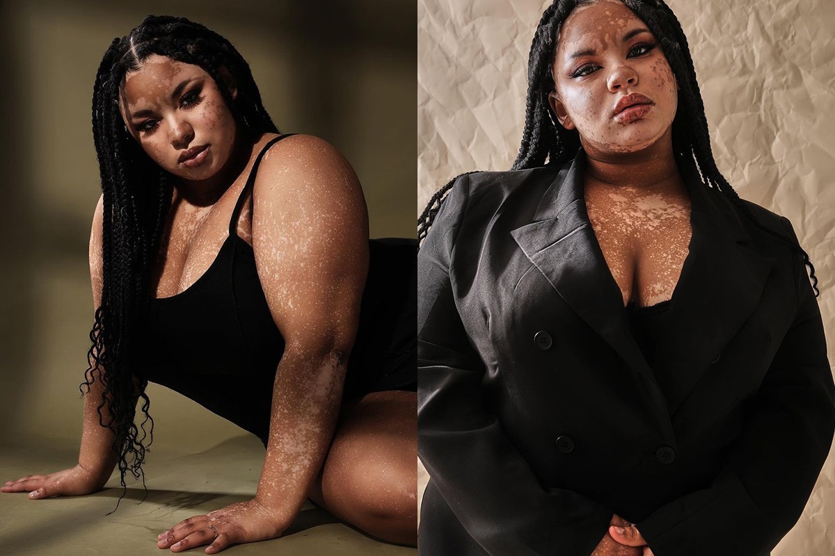 Nguoi mau ngoai co co lan da bach bien hinh anh