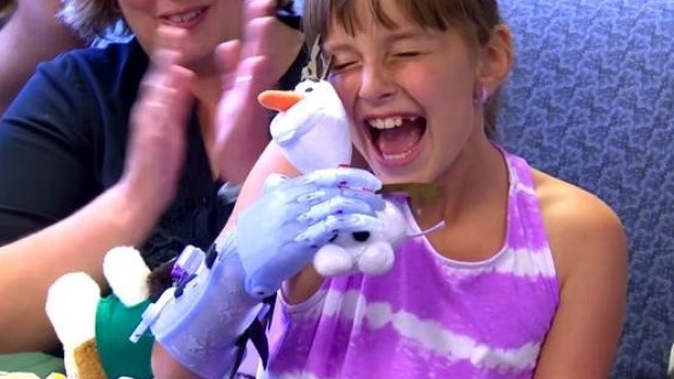 Cong nghe in 3D dem hanh phuc den cho co be khuyet tat hinh anh