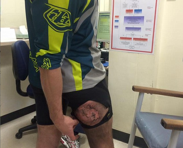 iphone phat no anh 2