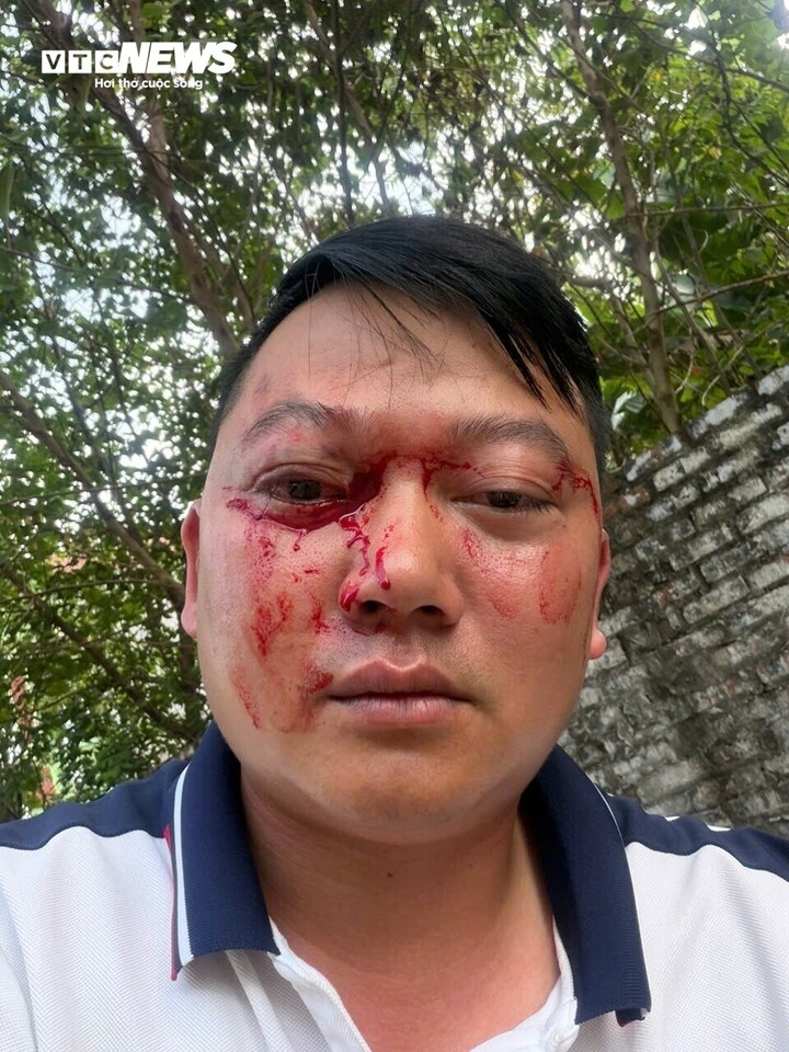 nạn nh&acirc;n ảnh 1