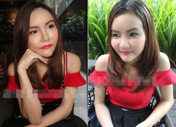  Tuy nhiên vì  chưa bình phục hoàn toàn sau ca phẫu thuật nên gương mặt nữ ca sĩ vẫn còn sưng và trông cứng. Anh Thúy tâm sự cô đang chờ ngày trở lại với nghệ danh mới Huyền Minh và mong người hâm mộ tha thứ cho lỗi lầm đã qua. 