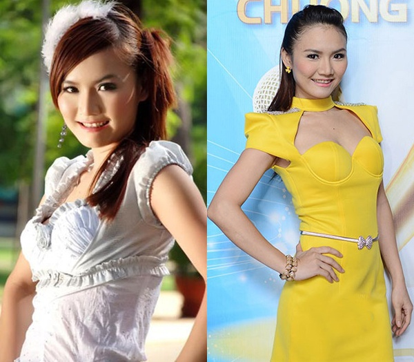 Sau khi gây scandal nói dối tại cuộc thi Nhân tố bí ẩn, mới đây cựu thành viên Mây Trắng Anh Thúy gây bất ngờ khi hình ảnh mới dao kéo của cô bị bắt gặp. Gương mặt Anh Thúy dường như thay đổi hoàn toàn: mũi và gò má cao hơn, cằm nhọn chữ V, làn da mịn màng không còn sẹo. 