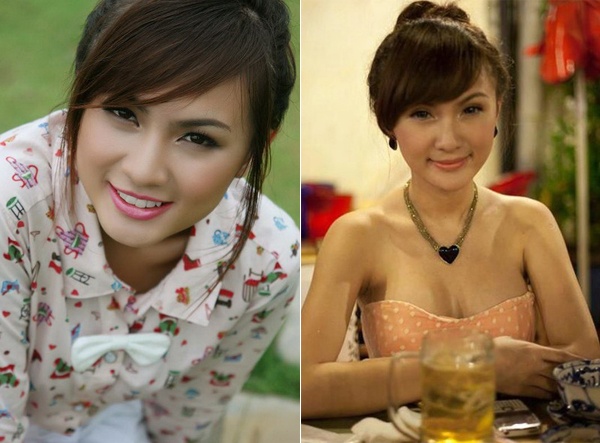 Dù gương mặt đã khá ưa nhìn nhưng hot girl Kelly Tú Anh vẫn muốn nâng cấp dung mạo, cô đi theo trào lưu gọt cằm nhưng không may bị hỏng và phải phẫu thuật tới 5 lần, thậm chí suýt bị hoại tử cằm.