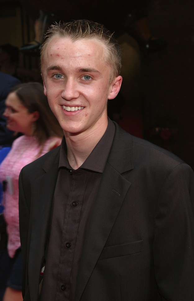 Tom Felton ( vai Draco Malfoy) trông không 