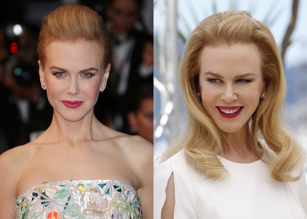 Trên thảm đỏ tại LHP Cannes hôm 14/5 vừa qua, minh tinh Nicole Kidman gây bất ngờ với gương mặt mới hoàn toàn khác biệt so với trước đó. Phần má và hốc mắt của mỹ nhân Grace of Monaco sưng to bất thường, thiếu tự nhiên. Nicole vốn không còn xa lạ với Botox nhưng dường như nữ diễn viên đang lạm dụng phương pháp làm đẹp này.