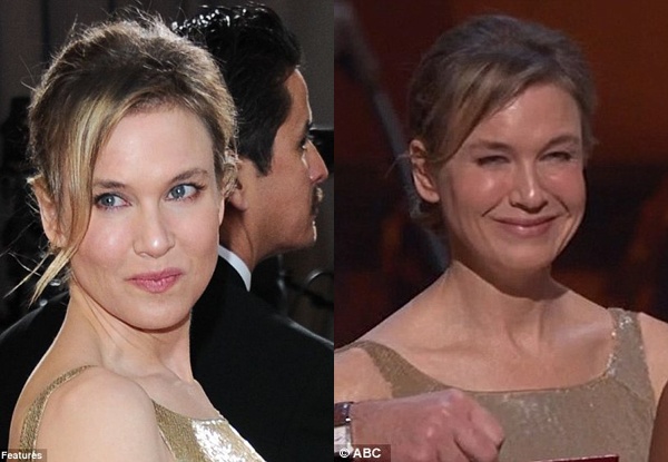 Gương mặt căng bóng mất tự nhiên của minh tinh Renee Zellweger tại lễ trao giải Oscar khiến cư dân mạng đoán rằng cô đã tiêm quá đà Botox. 