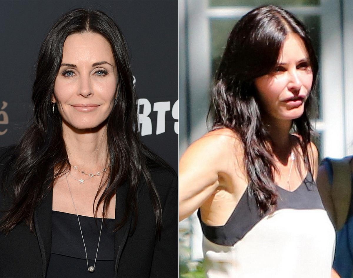 Ngôi sao truyền hình Courteney Cox cũng sử dụng Botox để căng da mặt lấy lại vẻ trẻ trung khi sắp bước vào U50 nhưng dường như cô đã áp dụng quá tay khiến gương mặt nhợt nhạt, méo mó.  