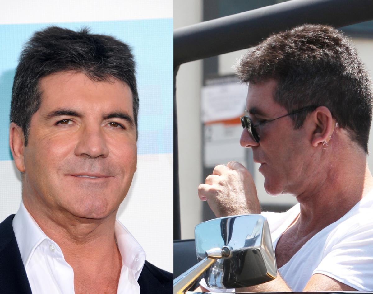Nhà sản xuất âm nhạc danh tiếng Simon Cowell là sao nam ít ỏi nghiện làm đẹp bằng công nghệ cao. Giám khảo X Factor từng tiết lộ đã tiêm Botox trong quá khứ nhưng hình ảnh mới của Simon chứng minh anh vẫn còn tìm đến Botox. Khi nhìn nghiêng có thể thấy rõ hậu quả mà Botox để lại cho Simon. 