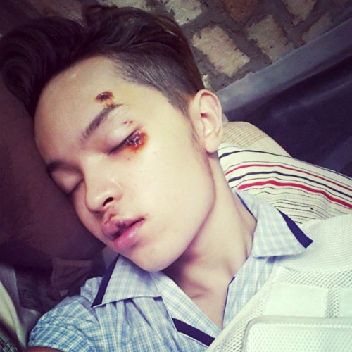 Cách đây không lâu, lúc 6 giờ sáng ngày 31/3, Kelbin đi một mình tới trường quay bộ phim Tiệm Bánh Hoàng Tử Bé, khi di chuyển ở cung đường Tôn Thất Thuyết, quận 4, TP.HCM, Kelbin bị một tên cướp áp sát xe, giật túi xách. Vì quá bất ngờ, nam diễn viên không kịp phản ứng và ngã xuống đường. Cú ngã khiến Kelbin gãy răng, trật bả vai, xương xậu,...  Được cấp cứu tại bệnh viện, hình ảnh Kelbin băng bó không khỏi gây xót xa cho người hâm mộ, anh phải tạm hoãn mọi hoạt động để điều trị.