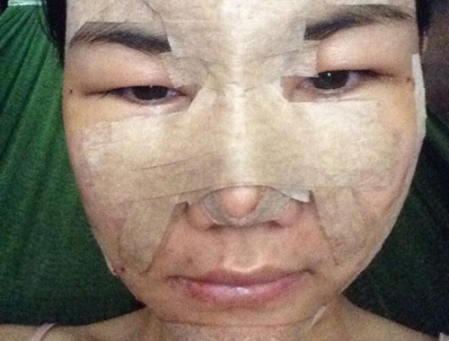 Anh Thuy tiet lo anh sung vu khi phau thuat tham my hinh anh