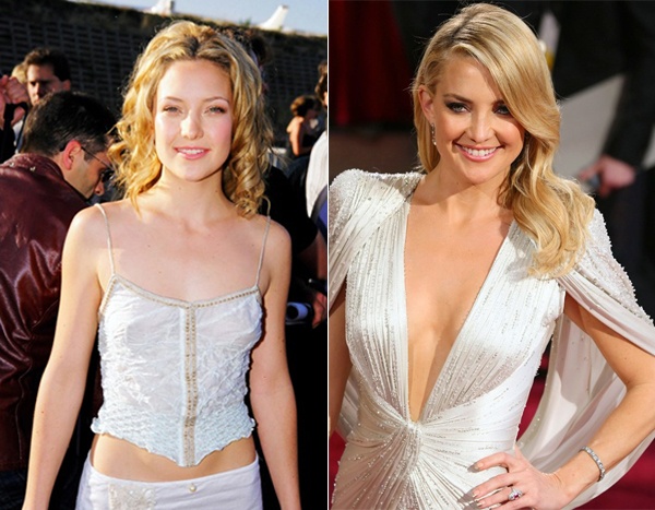 Nâng ngực giúp nữ diễn Kate Hudson gợi cảm hơn thời vòng 1 của cô bị gọi là “màn hình phẳng”. Kate đã có thể diện những bộ váy xẻ ngực. Mặc dù vậy, nữ diễn viên vẫn được biết tới là người đẹp có vòng 1 nhỏ nhắn nhất Hollywood. 