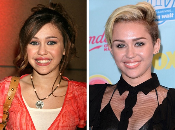 So với cách đây 7 năm khi còn là sao tuổi teen, Miley Cyrus hiện nay gợi cảm hơn về phong cách. Nữ ca sĩ trẻ đã đi làm lại răng đồng đều hơn, thêm vào đó là chiếc mũi cũng trở nên thanh gọn. Điều đặc biệt là chiếc mũi mới của Miley không có nhiều sự khác biệt, không dễ dàng để nhận ra dấu vết dao kéo.