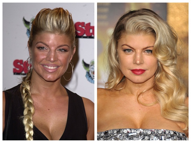 Nữ ca sĩ Fergie rõ ràng đã đi tút tát lại gương mặt nhưng khó ai có thể nhận ra vị trí nào được dao kéo. Ngoại trừ việc hiệu quả rõ rệt, Fergie trở nên đẹp và trẻ hơn so với trước kia.