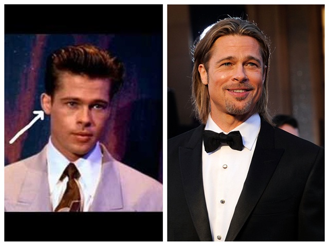 Thay vì giương mặt, tài tử Brad Pitt nhờ đến phẫu thuật thẩm mỹ chỉ để làm cho vành tai của anh trông dễ nhìn hơn và chỉ có vậy.