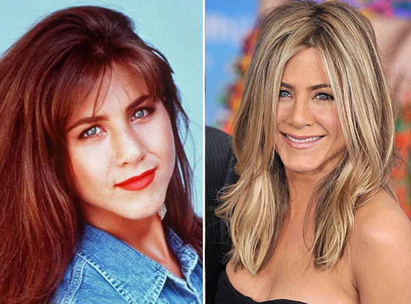 Can thiệp dao kéo để biến chiếc mũi to quá khổ trở nên thon gọn là quyết định đúng đắn của minh tinh Jennifer Aniston. Gương mặt nhỏ của cô chỉ đẹp hơn nếu chiếc mũi đồng đều với những bộ phận khác.