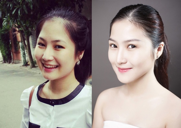 Nữ ca sĩ trẻ giải thích vì lý do tướng mạo nên cô muốn chỉnh sửa phần mũi và đã được gia đình đồng ý trước đó. Hương Tràm cũng gửi lời xin lỗi trước công chúng và mong nhận được sự thông cảm bởi cô cũng muốn xuất hiện thật chỉn chu trước khán giả.Trước thái độ thành thật, người hâm mộ cũng dần chấp nhận diện mạo mới của Hương Tràm.