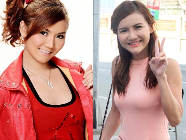 Nữ ca sĩ được tài trợ toàn bộ chi phí để có được gương mặt V-line và làn da trắng mịn không còn vết sẹo. Anh Thúy khá cởi mở về chuyện dao kéo, cô cho biết: “Tôi phải xuất hiện để có tiền trang trải cuộc sống”. Cách đây vài ngày, Anh Thúy còn khoe bức ảnh gương mặt sưng vù sau khi phẫu thuật. 