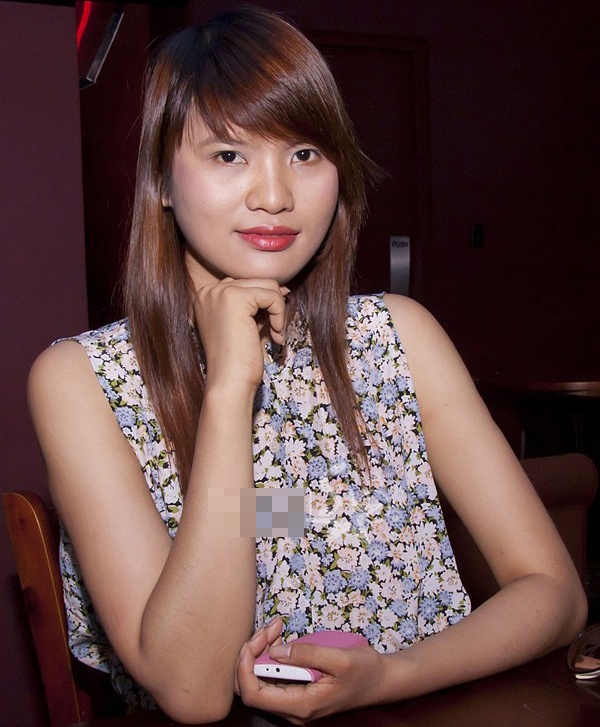 Sau cuộc thi Next Top Model, chân dài Lê Thị Phương gia nhập showbiz với biệt danh “gái quê” vì gương mặt có nhiều nhược điểm như to tròn, có phần thô cùng sống mũi thấp và hàm răng xỉn màu. 