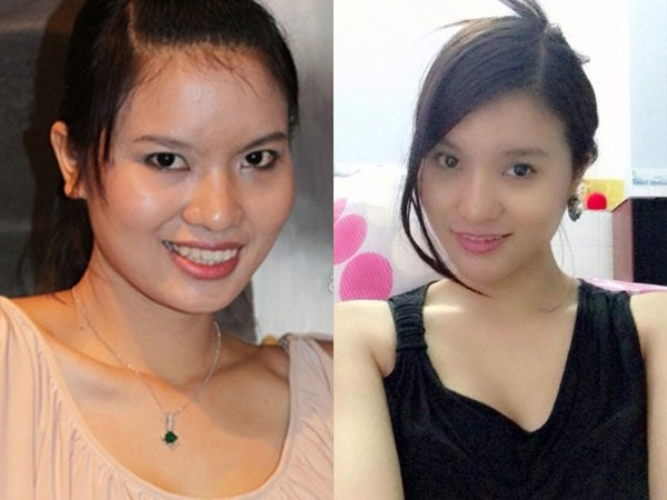 . Để cải thiện nhan sắc, Lê Thị Phương đã hai lần sửa mũi và thu gọn cằm cũng như làm lại răng. Kết quả sau những ngày đau đớn vì dao kéo là khuôn mặt thon gọn, thanh thoát, Lê Thị Phương từ đó cũng đắt show thời trang, chụp ảnh. 