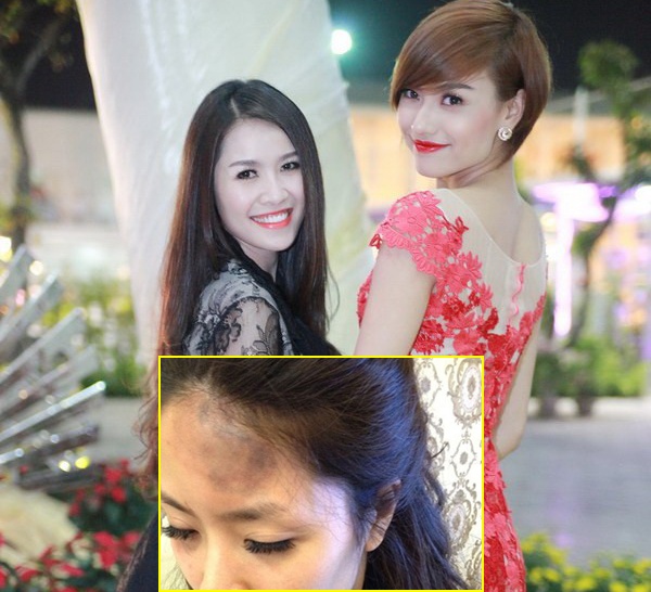 Chân dài Hồng Quế năm nay mới 20 tuổi nhưng đã gây ra nhiều vụ scandal khiến công chúng mất lòng. Một trong số những tai tiếng của người mẫu trẻ là lần cô bị tố cáo và ca sĩ Quế Vân bị tố đánh người hồi tháng 4/2012. 